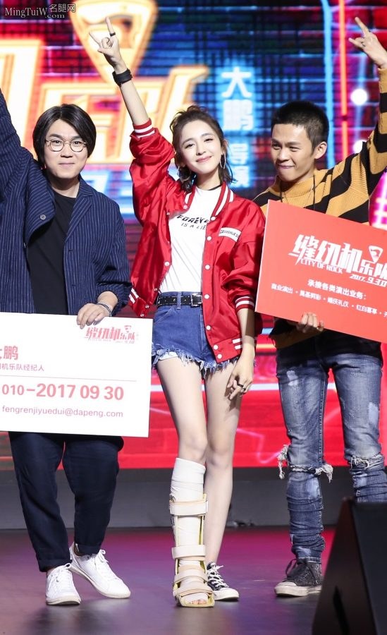 古力娜扎右腿上打了石膏 BF风外套加贝斯摇滚味十足(8/9)